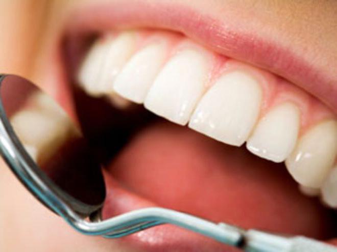 Treatment with dental gel 