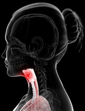 esophageal cancer symptoms and signs